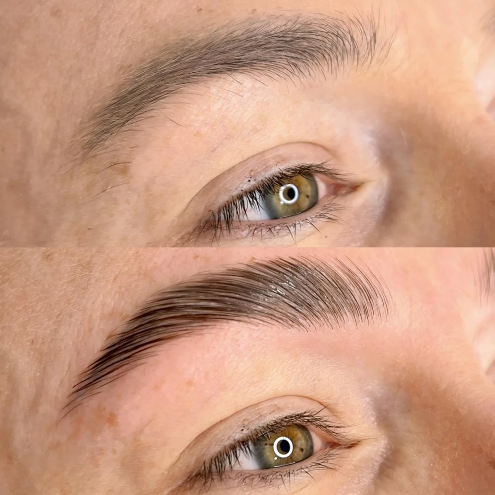 Procedimento de Brow Lamination